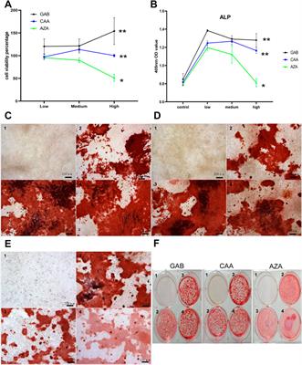 Herbal formula xuling-jiangu improves bone metabolic balance in rats with ovariectomy-induced osteoporosis via the gut-bone axis